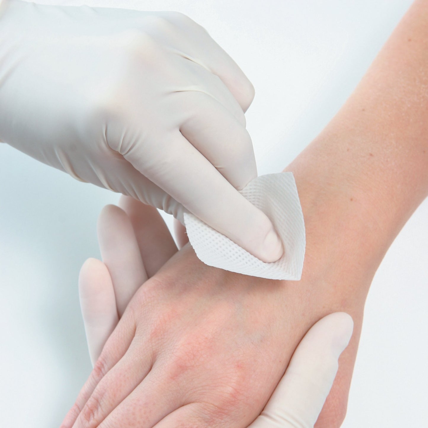 PDI® Adhesive Remover Pad 100 per Box (188675_CS)