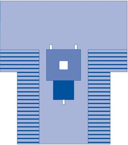 pediatric-laparotomy-t-drape-sterile-10-cs-dynjp3009_1