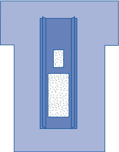femoral-angiography-drape-with-pouch-sterile-8-cs-dynjp4004_1