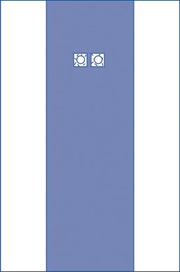 sterile-femoral-angiography-surgical-drape-with-2-windows-80-x-135-dynjp4104h_1