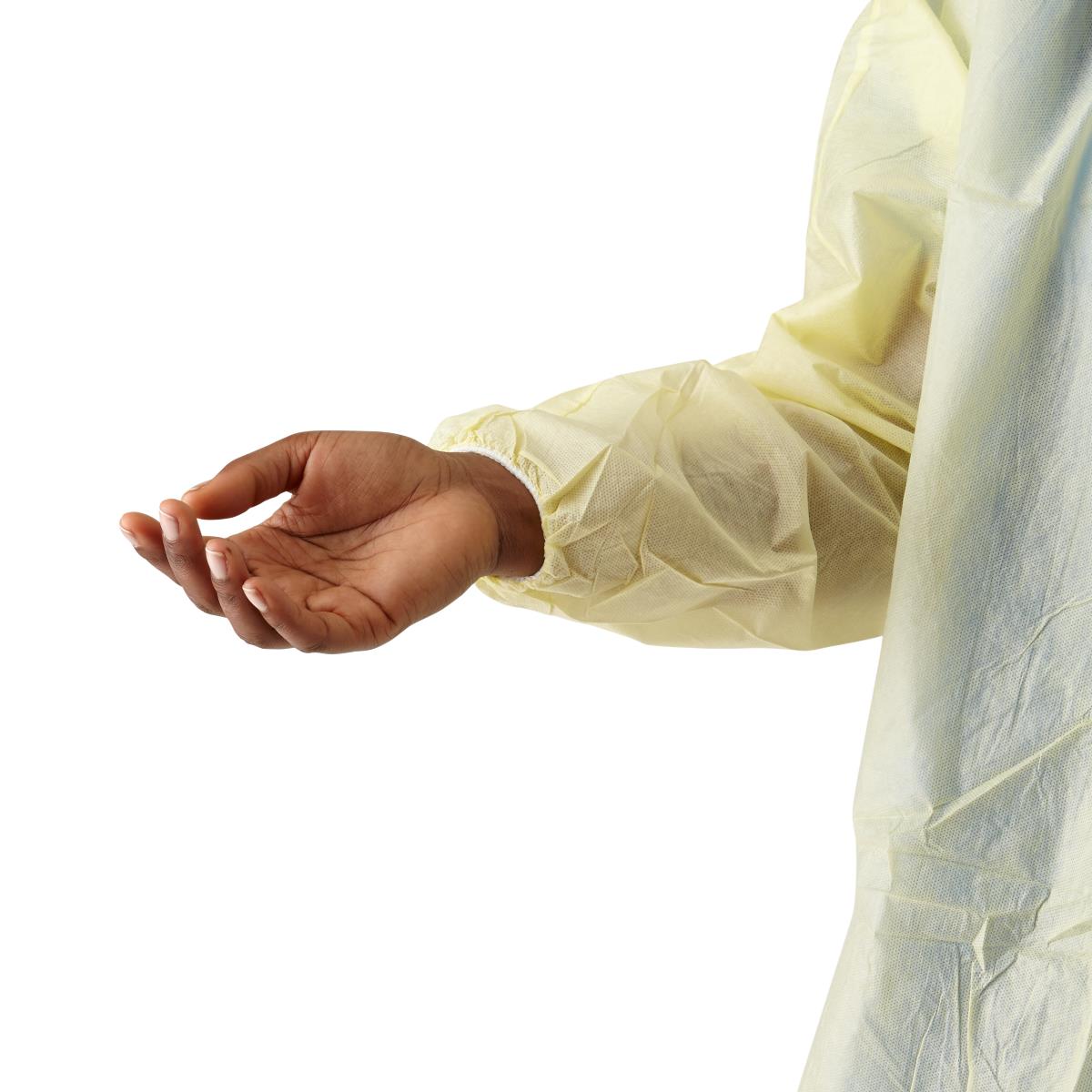 classic-cover-lightweight-spunbond-polypropylene-gowns-with-waist-and-neck-ties-yellow-size-xl-50-cs-cri4001_1