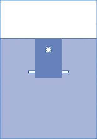 neonatal-drape-sheet-66-x-95-sterile-15-cs-dynjp3104_1