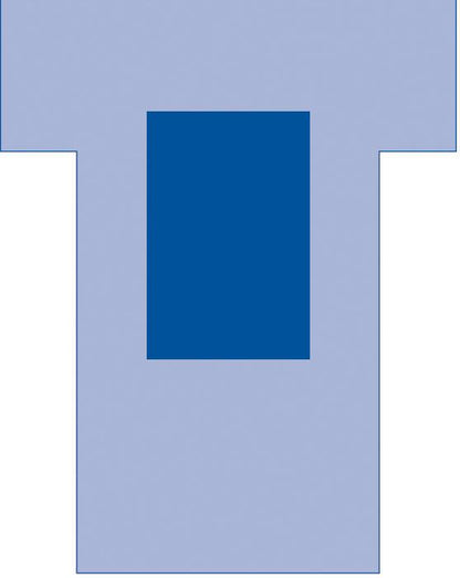 sterile-unfenestrated-cardiovascular-split-drape-119-x-150-x-79-10-cs-dynjp4001_1