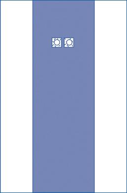 sterile-femoral-angiography-surgical-drape-with-2-windows-extended-reinforcement-dual-fenestrations-with-35-apertures-80-x-125-dynjp4102h_1