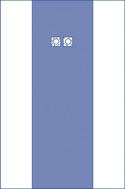 sterile-femoral-angiography-surgical-drape-with-2-windows-extended-reinforcement-dual-fenestrations-with-35-apertures-80-x-125-dynjp4102_1