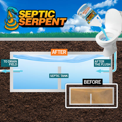 Hospeco® Septic Serpent Septic Tank Cleaner 32 oz (1 Quart), Case of 12 (HOSSEPTIC-32)