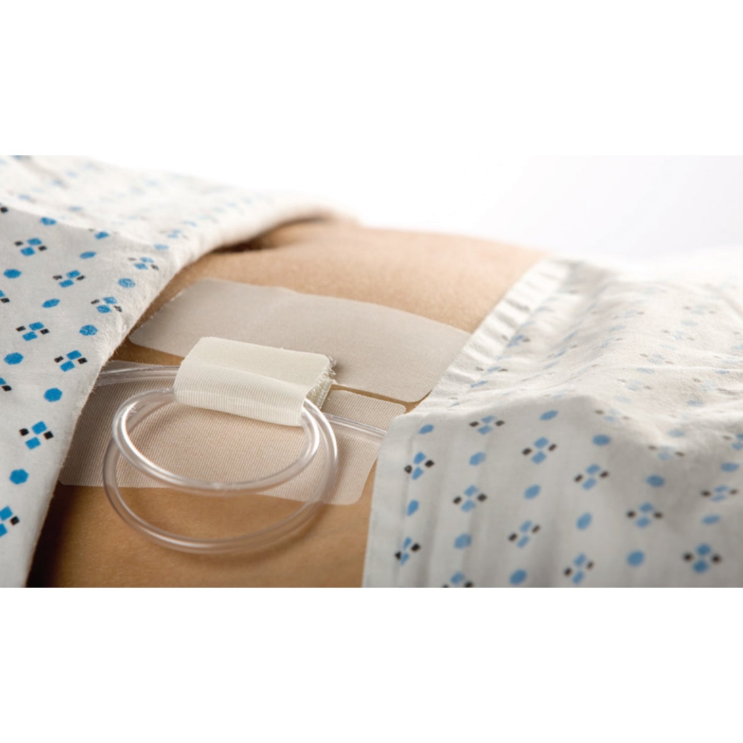 Cath-Secure™ Holder, Tube Single Hook and Loop Tab, Hypoallergenic Tape, Butterfly Design (192067_BX)