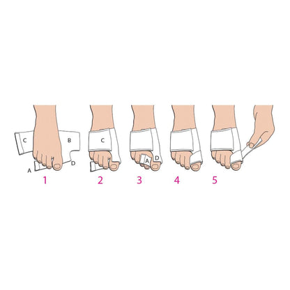 Softsplint™ Bunion Splint Medium Left Foot (890216_EA)