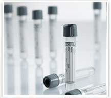 VACUETTE® Venous Blood Collection Tube Sodium Fluoride / Potassium Oxalate Additive 6 mL Pull Cap Polyethylene Terephthalate (PET) Tube (505513_PK)