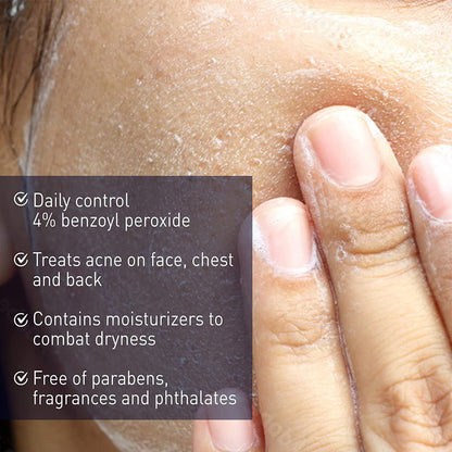 PanOxyl® Acne Treatment 6 oz. Cream (1147715_EA)