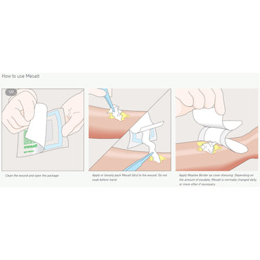 Mesalt® Sodium Chloride Impregnated Dressing Ribbon 3/4 X 39 Inch Sterile (1087157_EA)