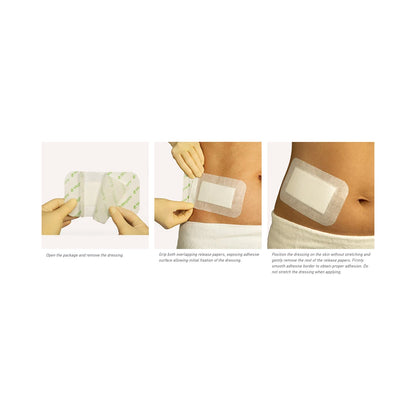 Mepore® Composite Dressing 3-3/5 X 8 Inch Rectangle Sterile (787100_BX)
