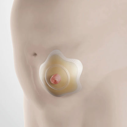 SenSura® Mio Convex Flip Ostomy Barrier Precut, Extended Wear Elastic Adhesive 50 mm Flange Red Code System 1-3/16 Inch Opening (1124375_BX)