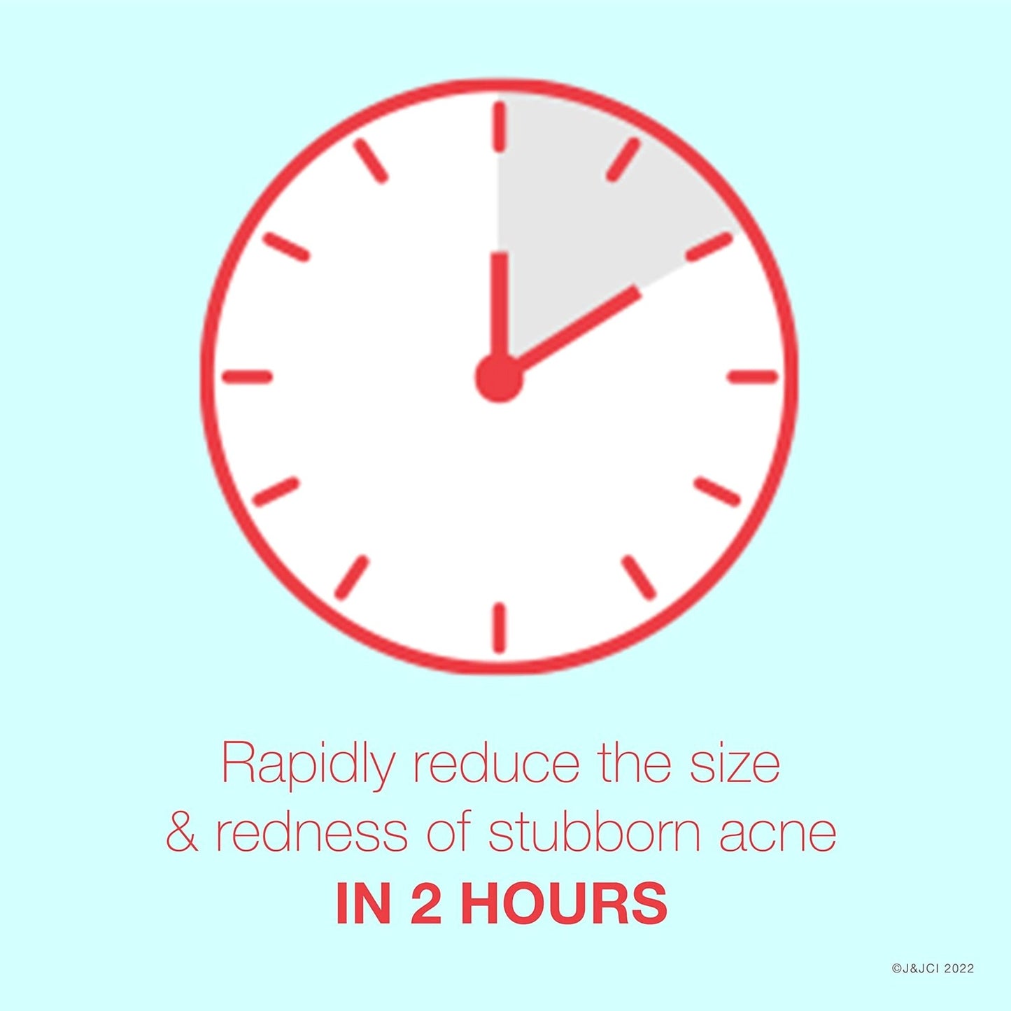 Neutrogena® Rapid Clear Acne Treatment 1 oz. Gel (1250875_EA)