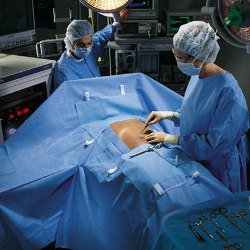 O&M Halyard Inc Abdominal Drape Laparoscopic / Abdominal Drape 100 W X 76 W X 124 L Inch Sterile (471282_EA)