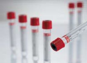 VACUETTE® Z Serum Sep Clot Activator Venous Blood Collection Tube Clot Activator / Separator Gel Additive 8 mL Pull Cap Polyethylene Terephthalate (PET) Tube (409479_CS)