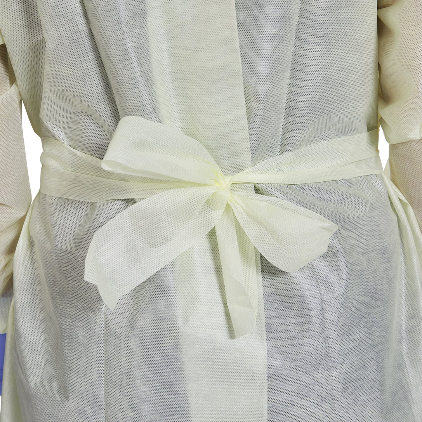 McKesson Protective Procedure Gown One Size Fits Most Yellow NonSterile AAMI Level 2 Disposable (1247991_BG)