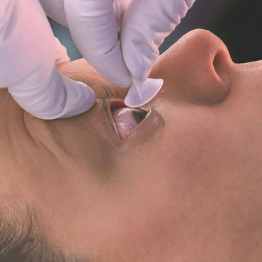 The Morgan® medi-Flow® Lens Occular Irrigation Device The Morgan® medi-Flow® Lens (382261_EA)