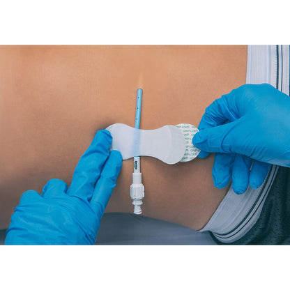 Grip-Lok® Catheter / Line Securement Device Grip-Lok® (1084661_EA)