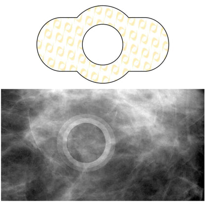 Spee-D-Ring™ Radiology Skin Marker Spee-D-Ring™ (880906_BX)