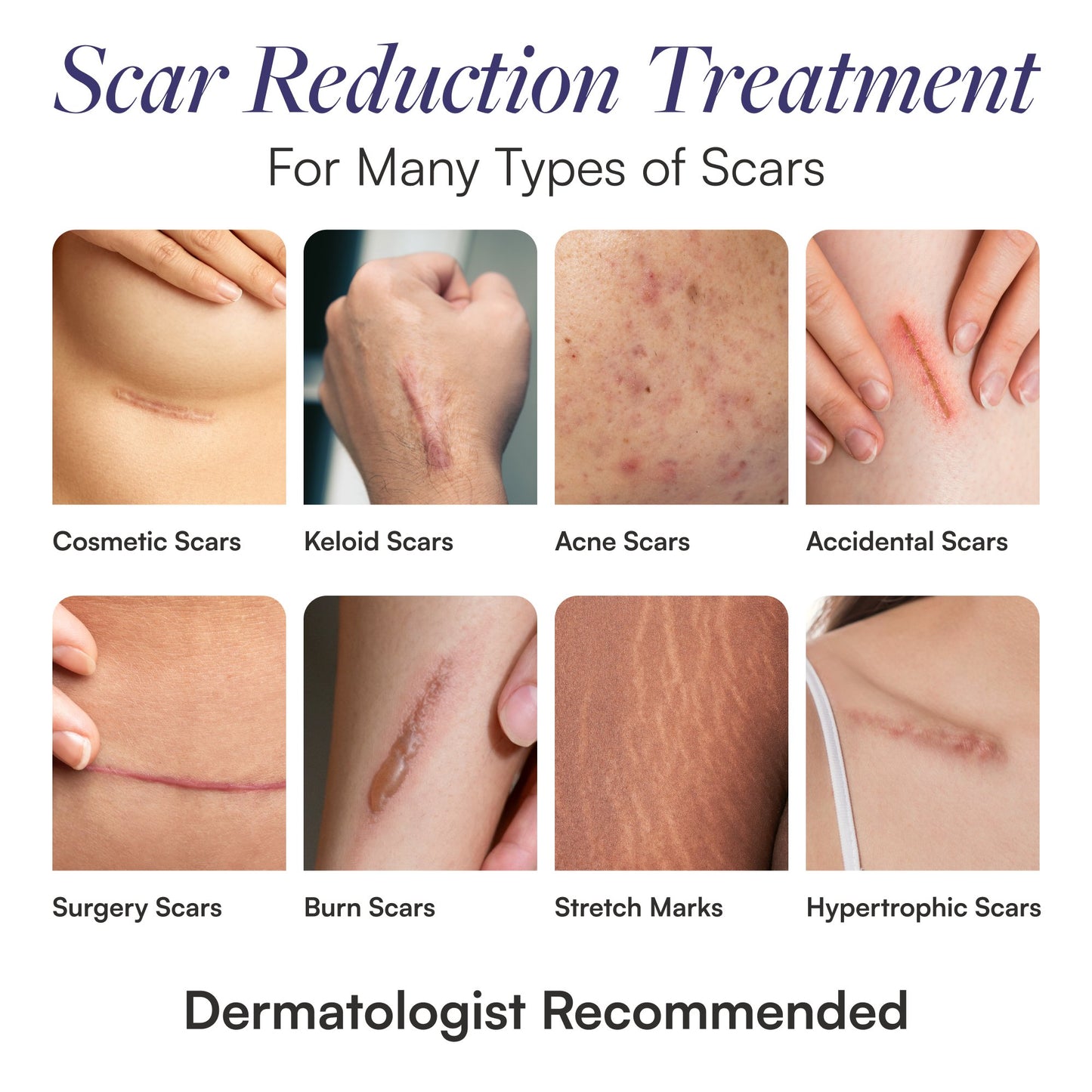 Skintensive® Scar Treatment 1.5 oz. Tube Unscented Gel (1267995_EA)