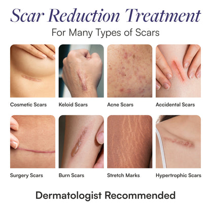 Skintensive® Scar Treatment 1.5 oz. Tube Unscented Gel (1267995_EA)